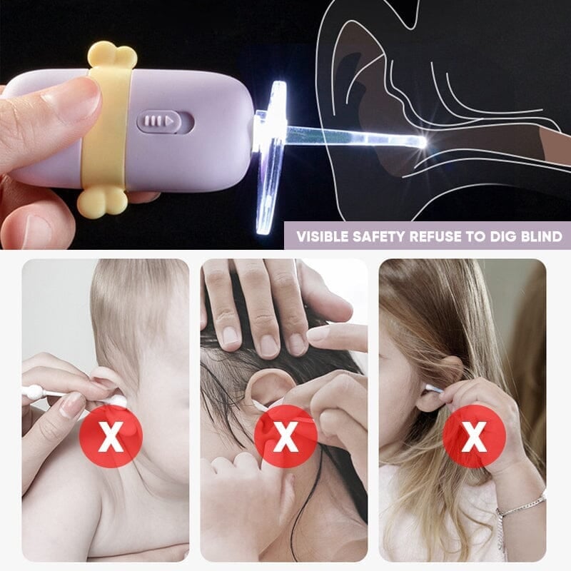 mamymarket™-LED Cartoon Baby Ear Cleaner Tool